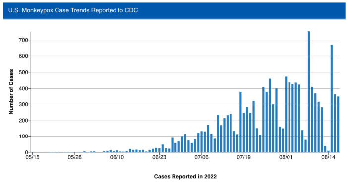 CDC monkeypox case statistics in the US states highest numbers trends ...